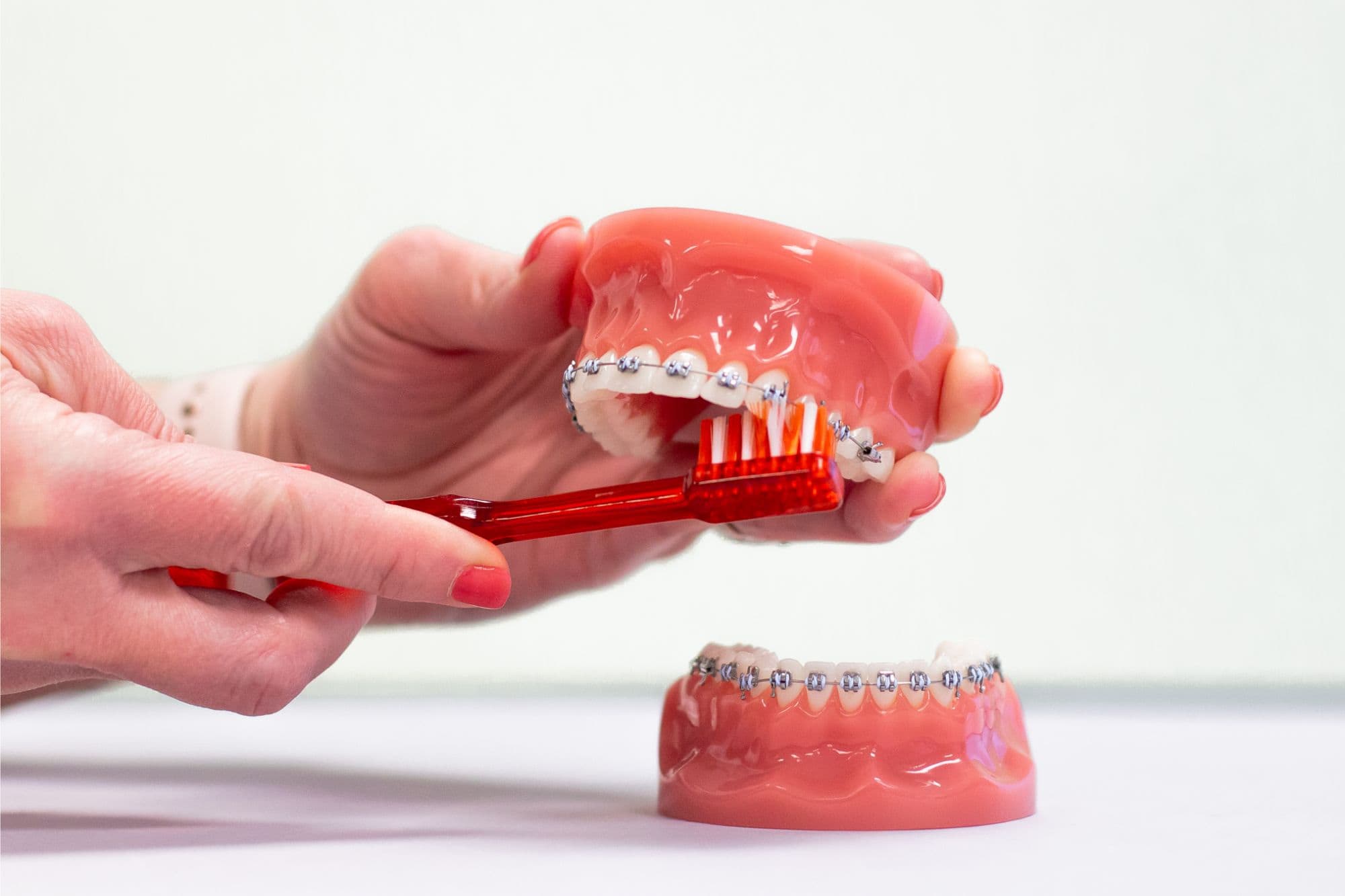 Caring for Braces
